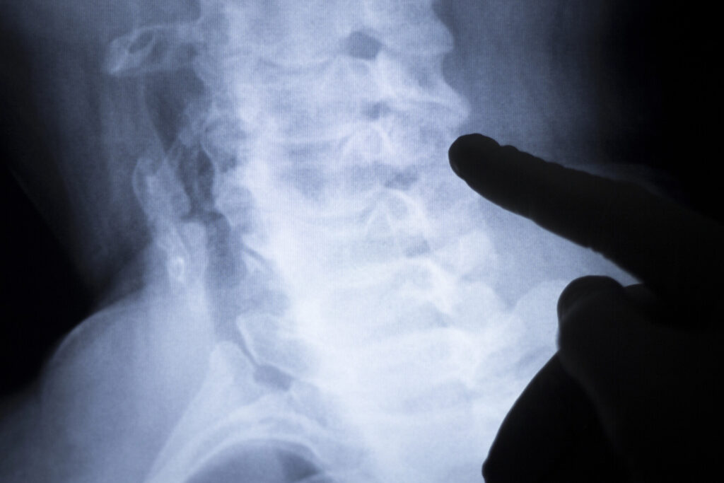 Calgary personal injury lawyers